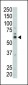 FYN Antibody (N-term)